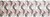 Фото Marazzi декор Eclettica Purple Decoro Etoile 40x120 (M2U3)